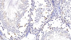 Invitrogen PGP9.5 Polyclonal Antibody:Antibodies:Primary Antibodies