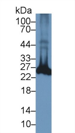 Invitrogen PGP9.5 Polyclonal Antibody:Antibodies:Primary Antibodies