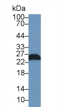 Invitrogen PGP9.5 Polyclonal Antibody:Antibodies:Primary Antibodies