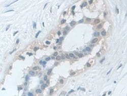 Invitrogen VCP Polyclonal Antibody 20 &mu;L; Unconjugated:Antibodies, Polyclonal