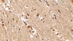 Invitrogen VCP Polyclonal Antibody 20 &mu;L; Unconjugated:Antibodies, Polyclonal