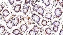 Invitrogen VCP Polyclonal Antibody 20 &mu;L; Unconjugated:Antibodies, Polyclonal