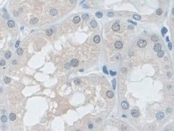 Invitrogen VCP Polyclonal Antibody 20 &mu;L; Unconjugated:Antibodies, Polyclonal