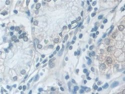 Invitrogen VCP Polyclonal Antibody 20 &mu;L; Unconjugated:Antibodies, Polyclonal