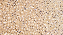 Invitrogen VCP Polyclonal Antibody 20 &mu;L; Unconjugated:Antibodies, Polyclonal