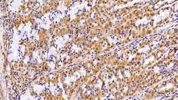 Invitrogen VCP Polyclonal Antibody 20 &mu;L; Unconjugated:Antibodies, Polyclonal