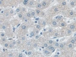 Invitrogen VCP Polyclonal Antibody 20 &mu;L; Unconjugated:Antibodies, Polyclonal
