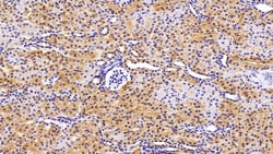 Invitrogen VCP Polyclonal Antibody 20 &mu;L; Unconjugated:Antibodies, Polyclonal