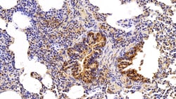 Invitrogen VCP Polyclonal Antibody 20 &mu;L; Unconjugated:Antibodies, Polyclonal