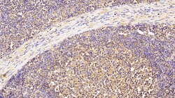 Invitrogen VCP Polyclonal Antibody 20 &mu;L; Unconjugated:Antibodies, Polyclonal