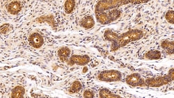 Invitrogen VCP Polyclonal Antibody 20 &mu;L; Unconjugated:Antibodies, Polyclonal