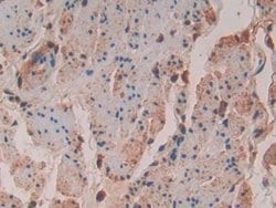 Invitrogen VAV3 Polyclonal Antibody 20 &mu;L; Unconjugated:Antibodies,