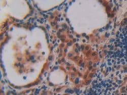 Invitrogen VAV3 Polyclonal Antibody 20 &mu;L; Unconjugated:Antibodies,