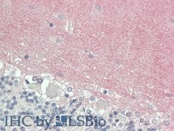 Invitrogen VCAN Polyclonal Antibody:Antibodies:Primary Antibodies