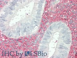 Invitrogen VCAN Polyclonal Antibody:Antibodies:Primary Antibodies