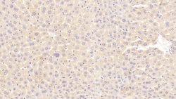 Invitrogen WFDC1 Polyclonal Antibody 200 &mu;L; Unconjugated:Antibodies,
