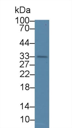 Invitrogen WFDC1 Polyclonal Antibody 20 &mu;L | Buy Online | Invitrogen&trade; | Fisher Scientific