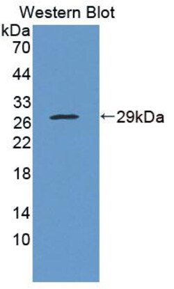 Invitrogen WFDC1 Polyclonal Antibody 20 &mu;L | Buy Online | Invitrogen&trade; | Fisher Scientific