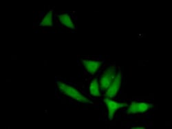 Invitrogen XIAP Polyclonal Antibody:Antibodies:Primary Antibodies