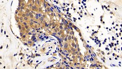 Invitrogen XIAP Polyclonal Antibody:Antibodies:Primary Antibodies