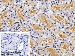 Invitrogen XIAP Polyclonal Antibody:Antibodies:Primary Antibodies