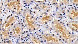 Invitrogen XIAP Polyclonal Antibody:Antibodies:Primary Antibodies