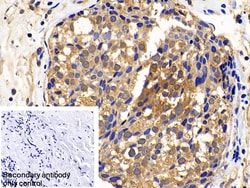 Invitrogen XIAP Polyclonal Antibody:Antibodies:Primary Antibodies