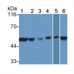 Invitrogen XIAP Polyclonal Antibody:Antibodies:Primary Antibodies