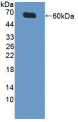 Invitrogen XIAP Polyclonal Antibody:Antibodies:Primary Antibodies