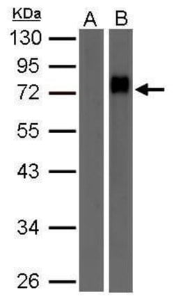 Invitrogen Biotin Polyclonal Antibody 100 &mu;L; Unconjugated:Antibodies,