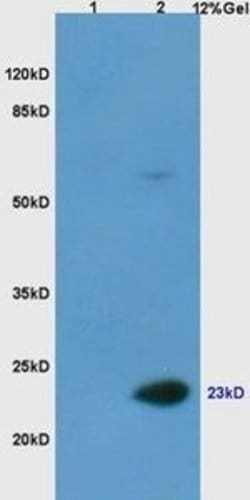 Invitrogen Casein Polyclonal Antibody 200 &mu;L; Unconjugated:Anticorps,