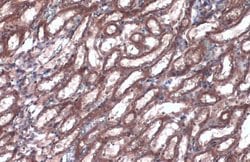 Caspase 1 p10 Polyclonal Antibody, Invitrogen 100 &mu;L; Unconjugated:Antibodies,
