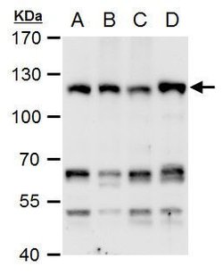 Invitrogen CHD1L Polyclonal Antibody 100 &mu;L; Unconjugated:Antibodies,