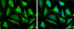 Invitrogen COX4I2 Polyclonal Antibody 100 &mu;L; Unconjugated:Antibodies,