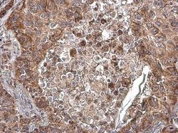 Invitrogen COX4I2 Polyclonal Antibody 100 &mu;L; Unconjugated:Antibodies,