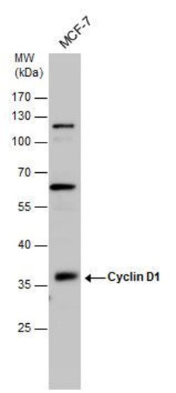 Invitrogen Cyclin D1 Polyclonal Antibody 100 &mu;L | Buy Online | Invitrogen&trade; | Fisher Scientific