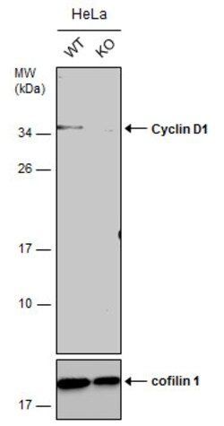 Invitrogen Cyclin D1 Polyclonal Antibody 100 &mu;L | Buy Online | Invitrogen&trade; | Fisher Scientific
