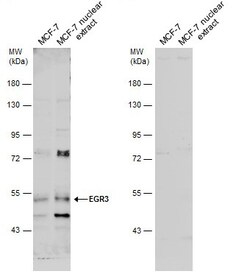 Invitrogen EGR3 Polyclonal Antibody 100 &mu;L; Unconjugated:Antibodies,