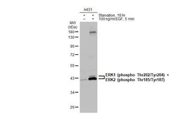 Invitrogen Phospho-ERK1/ERK2 (Thr185, Tyr187, Thr202, Tyr204) Polyclonal Antibody 100 &mu;L | Buy Online | Invitrogen&trade; | Fisher Scientific