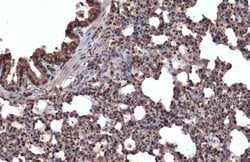 Invitrogen ERK2 Polyclonal Antibody 100 &mu;L; Unconjugated:Antibodies,
