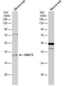Invitrogen GNAT2 Polyclonal Antibody 100 μL; Unconjugated:Antibodies,