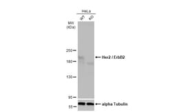 Invitrogen ErbB2 (HER-2) Polyclonal Antibody 100 &mu;L; Unconjugated:Antibodies,