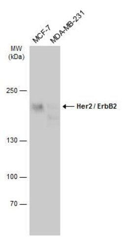 Invitrogen ErbB2 (HER-2) Polyclonal Antibody 100 &mu;L; Unconjugated:Antibodies,