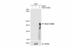 Invitrogen ErbB2 (HER-2) Polyclonal Antibody 100 &mu;L; Unconjugated:Antibodies,