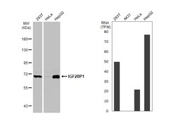 Invitrogen IGF2BP1 Polyclonal Antibody 100 &mu;L; Unconjugated:Antibodies,