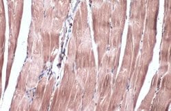 Invitrogen IRS2 Polyclonal Antibody 100 μL; Unconjugated:Antibodies,