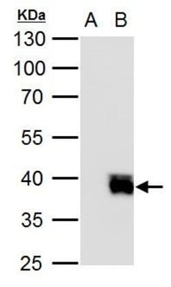Invitrogen ISL2 Polyclonal Antibody 100 &mu;L; Unconjugated:Antibodies,