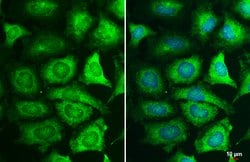Invitrogen MEK1 Polyclonal Antibody 100 &mu;L; Unconjugated:Antibodies,