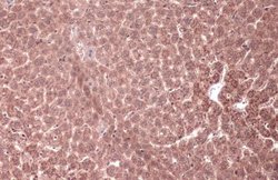 Invitrogen MEK1 Polyclonal Antibody 100 &mu;L; Unconjugated:Antibodies,