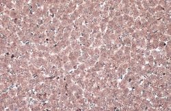 Invitrogen MEK1 Polyclonal Antibody 100 &mu;L; Unconjugated:Antibodies,